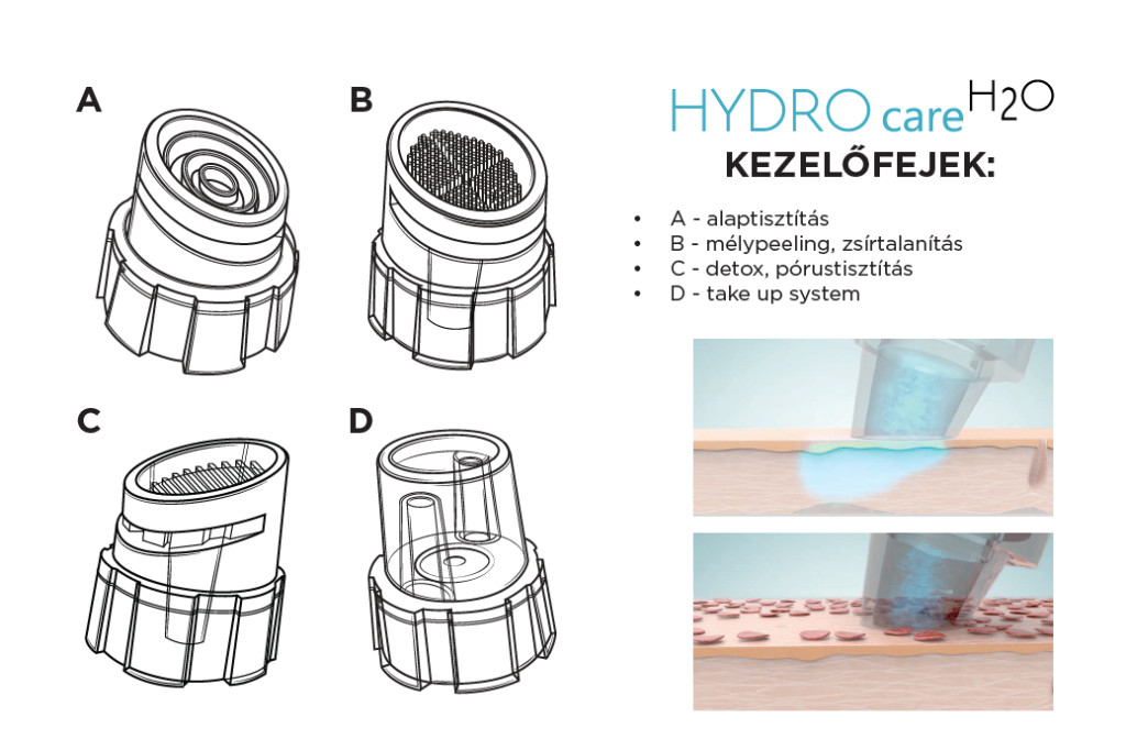 S'METICS Hydro 1.0 gép kezelőfej tip - 8db-os készlet